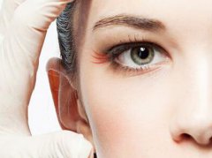 激光去魚尾紋保持多久 術(shù)后如何護理