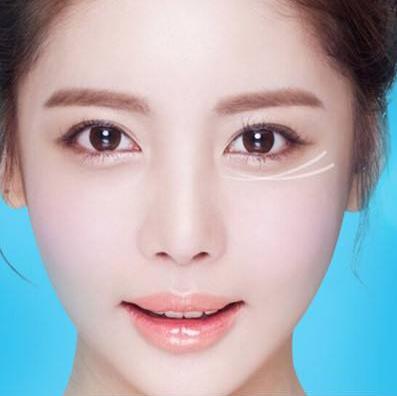 深圳超聲波祛眼袋價(jià)格