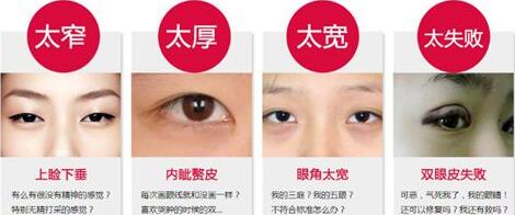 廣東眼部整形失敗修復(fù)手術(shù)費(fèi)用