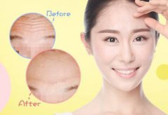 抬頭紋怎么調(diào)節(jié)？調(diào)節(jié)抬頭紋方法有哪些？