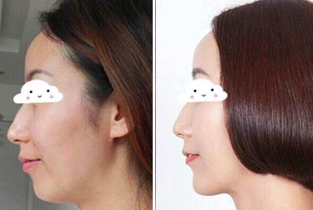 瑞蘭2號(hào)多少錢(qián)一支