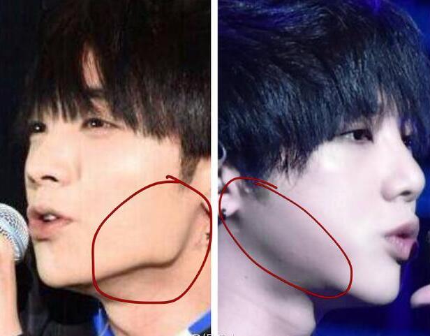 華晨宇整容前后照片 華晨宇做了下頜角整形？
