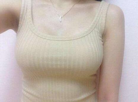 北京做假體豐胸價格是多少錢呢