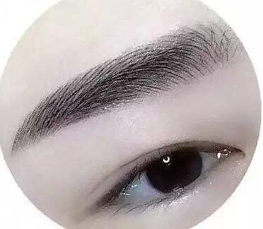 種植眉毛調(diào)節(jié)眉毛缺損手術(shù)是什么？