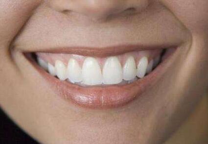 種植牙和烤瓷牙的區(qū)別有哪些？