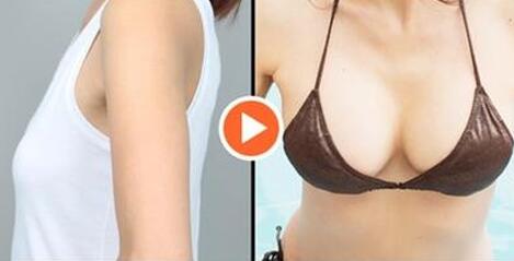 上海假體豐胸費用、上海假體豐胸手術(shù)多少錢？