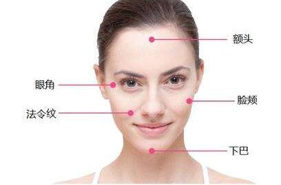 中面部提升術,維持多久