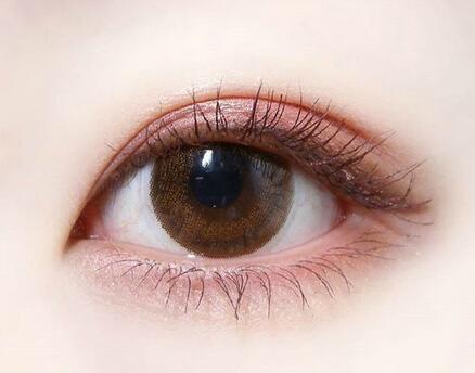 深圳割雙眼皮多少錢