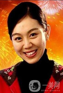 姜妍整容前后照片 堪稱丑小鴨變天鵝