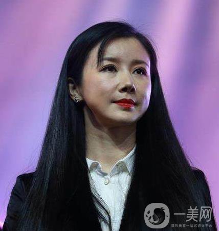 孫菲菲整容了嗎 孫菲菲整容前后圖片