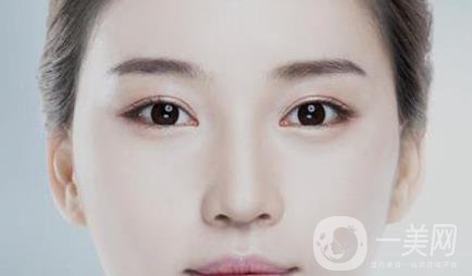 開眼角多久恢復(fù) 術(shù)后要如何護理