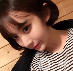 激光祛除黃褐斑要幾次