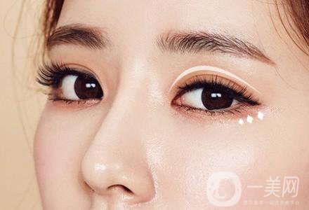 高分子雙眼皮是*嗎?高分子雙眼皮適合哪些人？