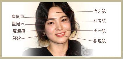 雙美膠原蛋白隆鼻怎么樣?*果能維持多久？