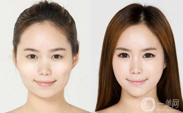 武漢注射*大概多少錢