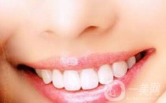 烤瓷牙多久換一次？烤瓷牙如何護(hù)理