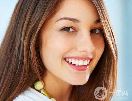 哪種烤瓷牙比較好 烤瓷牙種類介紹