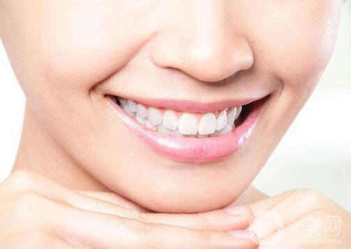 哪種烤瓷牙比較好 烤瓷牙種類介紹