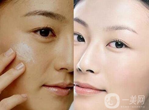 彩光嫩膚要多少錢？彩光嫩膚價(jià)格需要多少？