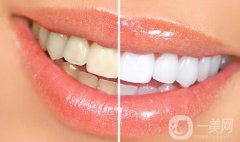 四環(huán)素牙怎么變白？四環(huán)素牙怎么辦？