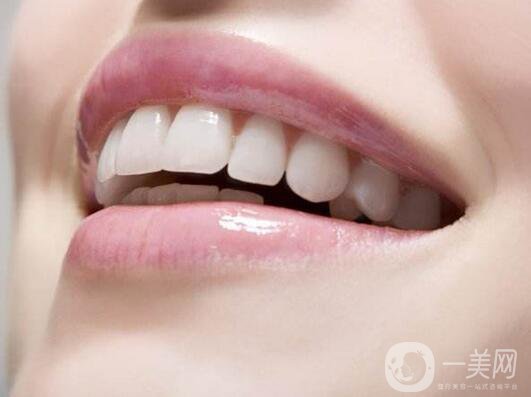 烤瓷牙價(jià)格和種類詳細(xì)介紹