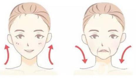 怎么除去法令紋？什么方法可以去法令紋？