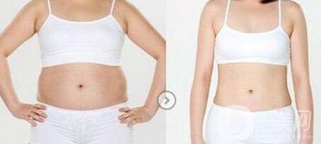 南京吸脂減肥的價格是多少？吸脂減肥大概多少錢？