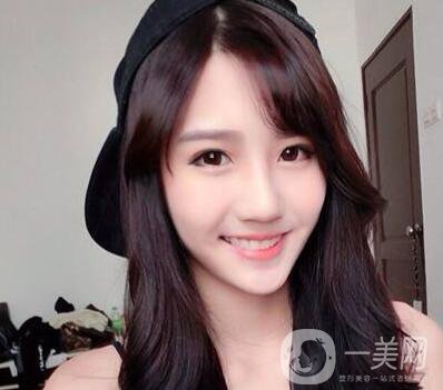 眼窩凹陷填充手術(shù)是什么 術(shù)后如何護理