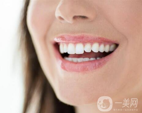 一口烤瓷牙多少錢 烤瓷牙價格盤點