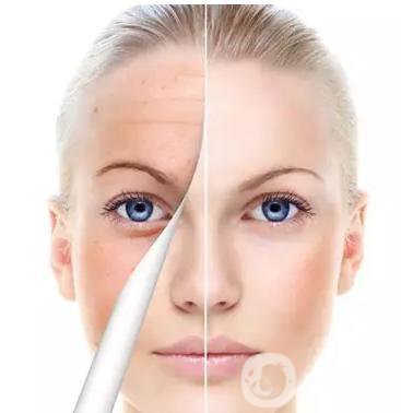 如何調(diào)節(jié)咖啡斑才*不反彈？