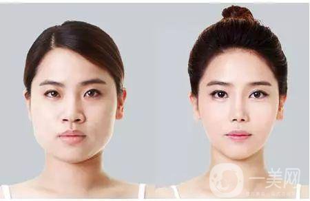 注射*大概需要多少錢？