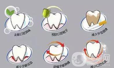 潔牙多少錢？成都潔牙價(jià)格貴嗎？