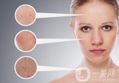 去黃褐斑的價格 去黃褐斑多少錢