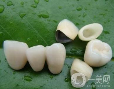 做完烤瓷牙可以使用多少年？