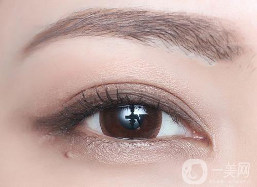 什么是高分子雙眼皮 價(jià)格多少錢？