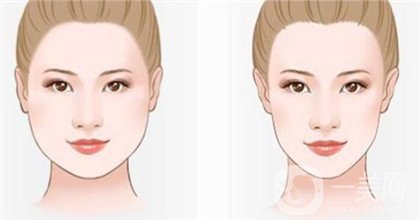 *一針要多少錢 正規(guī)醫(yī)院*價格貴嗎