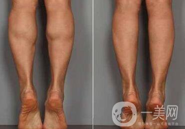 **果嗎、*有副作用嗎