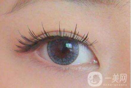 *術(shù)后注意事項(xiàng) 護(hù)理事項(xiàng)盤(pán)點(diǎn)