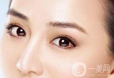 韓式三點(diǎn)雙眼皮的缺點(diǎn)詳細(xì)介紹 手術(shù)前后圖