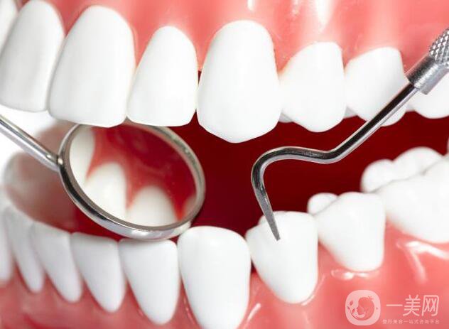 烤瓷牙種類及價格 烤瓷牙*果圖