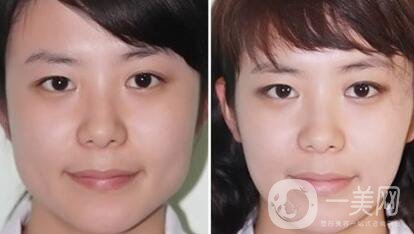 **多少錢 **價格詳解