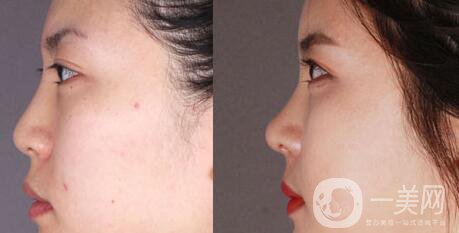 *術(shù)后1-7天的反應 *術(shù)后怎么護理