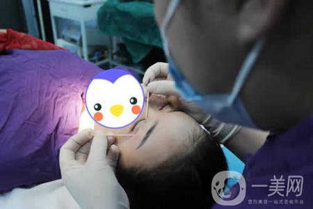 焊接雙眼皮是什么 后遺癥詳細(xì)介紹 