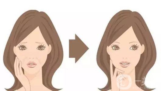 逸美玻尿酸價格 一般多少錢