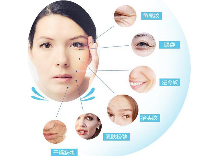 瑞蘭,注射除皺,多少錢(qián)