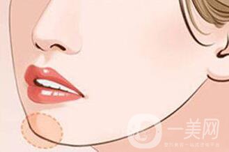 硅膠隆下巴,價(jià)格