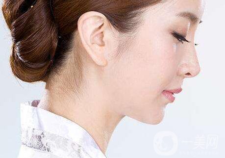 隆鼻危險嗎?隆鼻危險大嗎？