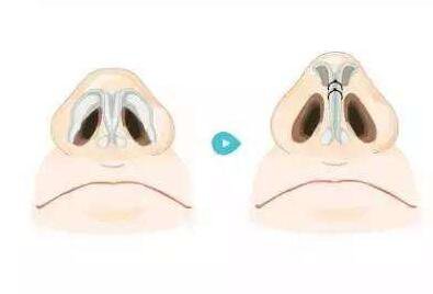 *包括哪些項(xiàng)目 *過(guò)程圖