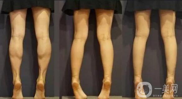 **多少錢 **具體價格介紹