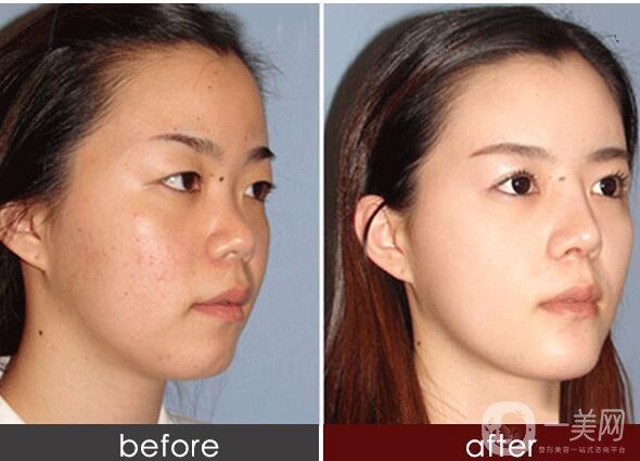 *,術(shù)后注意事項